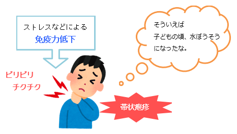 帯状疱疹 たいじょうほうしん とは 原因 症状 治療について